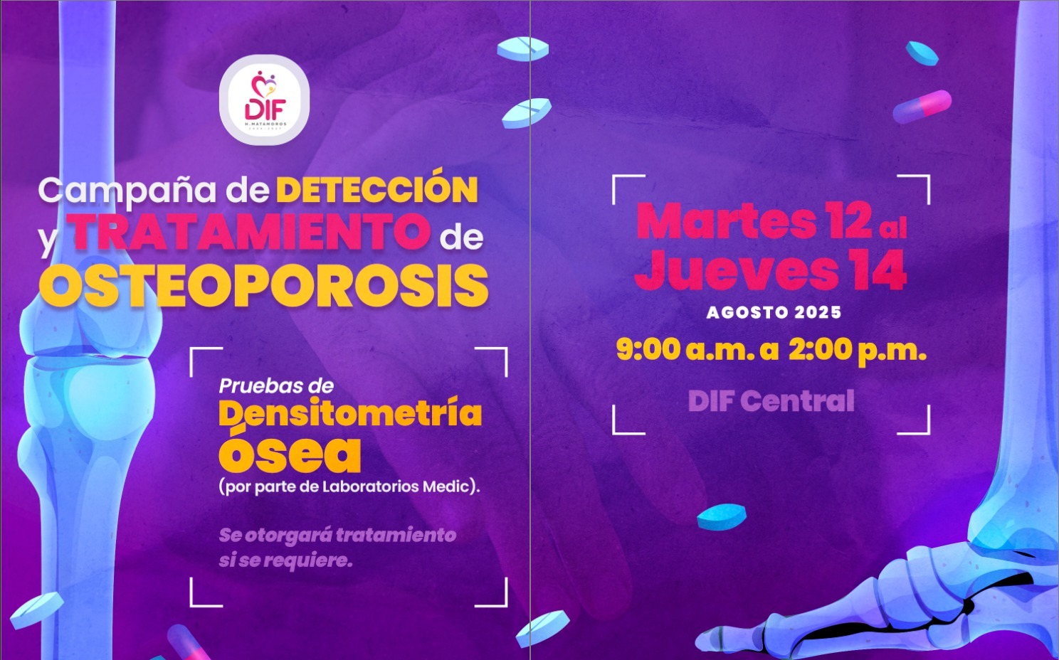 Invita DIF Matamoros a sumarse a la Campaña de Detección y Tratamiento de Osteoporosis